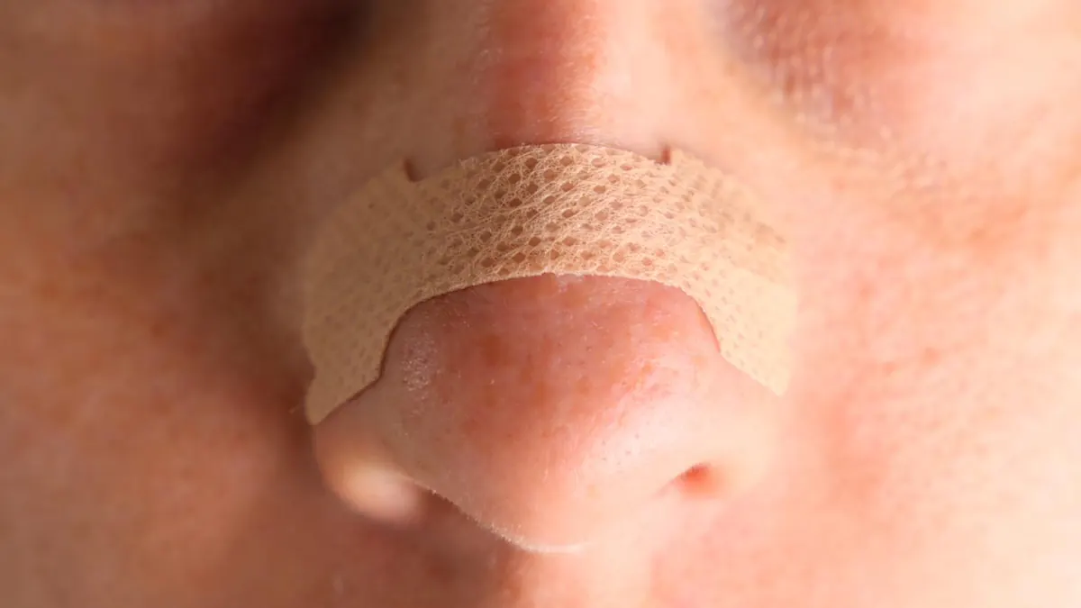 Close-up of a nasal strip placed across the nose, just above the nostril flare
