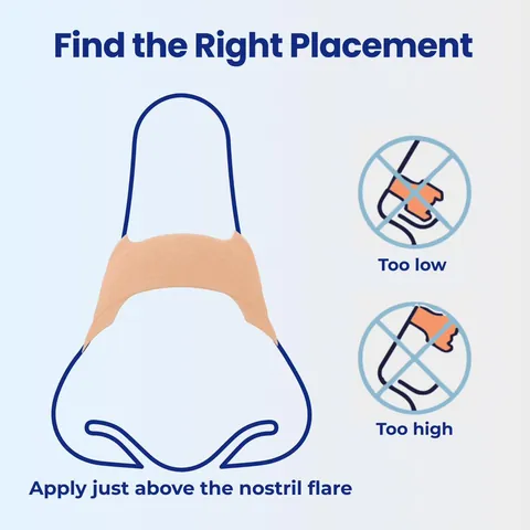 Placement guide showing a nasal strip applied just above the nostril flare, not too high or too low